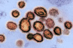 Частицы коронавируса на клетке заразившегося человека под микроскопом