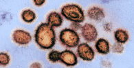 Частицы коронавируса на клетке заразившегося человека под микроскопом