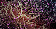 Измененные клетки человека после заражения коронавирусом, сфотографированные при помощи электронного микроскопа 