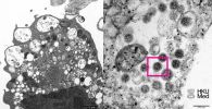 Ученые из Университета Гонконга опубликовали электронную микрофотографию омикрон-штамма