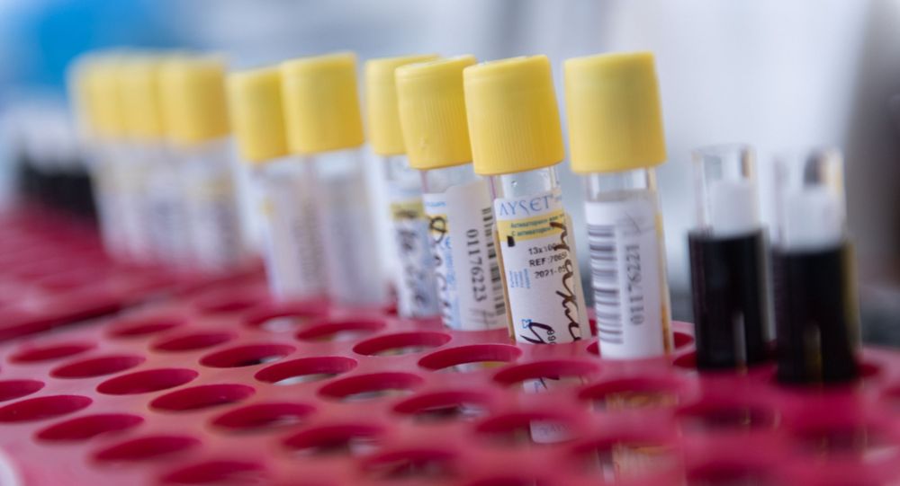 Пробирки с тестами на коронавирус в лаборатории 
