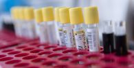 Пробирки с тестами на коронавирус в лаборатории 