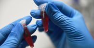 Образцы крови в лаборатории молекулярно-генетических методов 