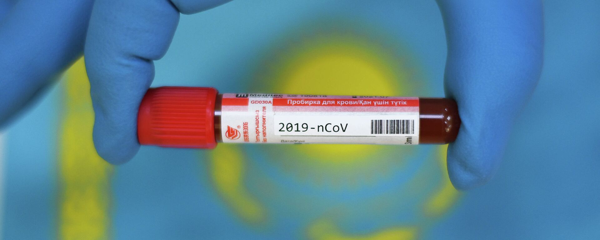 Пробирка с кровья для анализа COVID-19 - иллюстративное фото - Sputnik Казахстан, 1920, 04.03.2023
