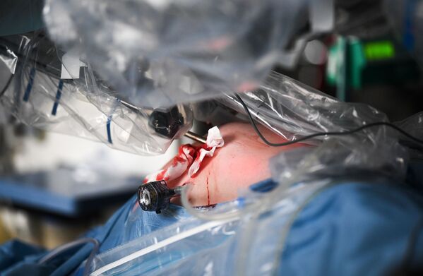 Робот-хирург Да Винчи во время хирургической операции в городской клинической больнице №50 в Москве - Sputnik Қазақстан