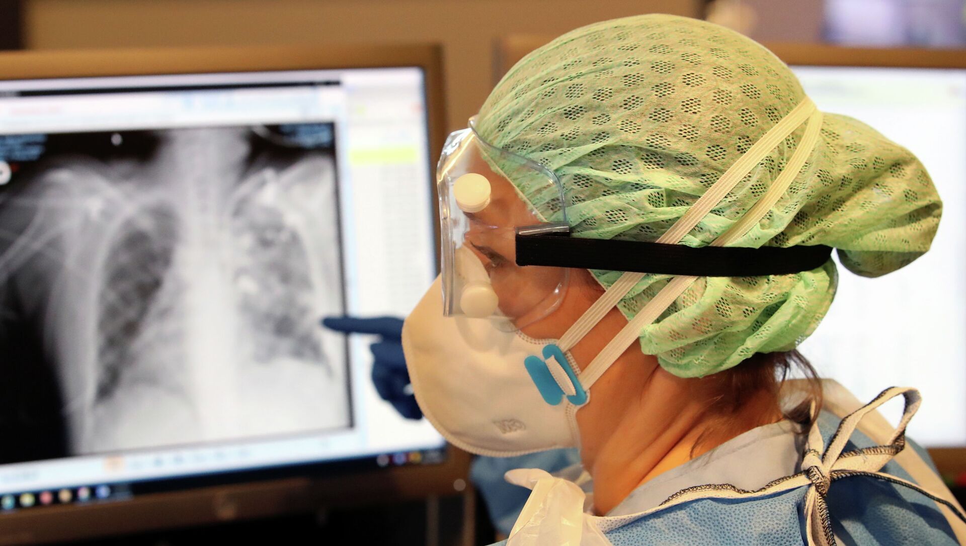 Медик в защитном костюме рассматривает рентгеновский снимок в больнице с коронавирусом - Sputnik Казахстан, 1920, 19.05.2021