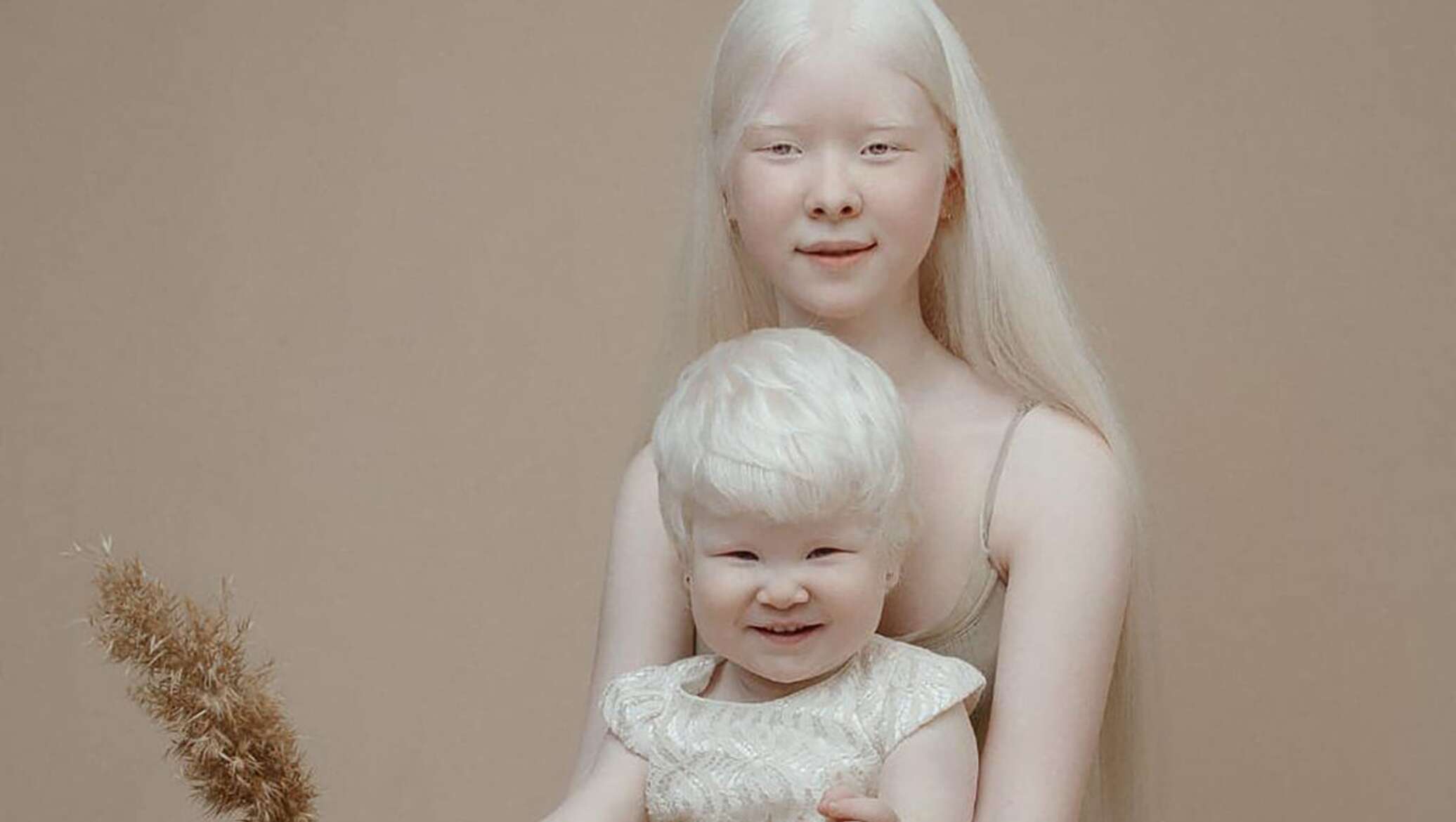 Как люди рождаются альбиносами. Альбинизм 1в.