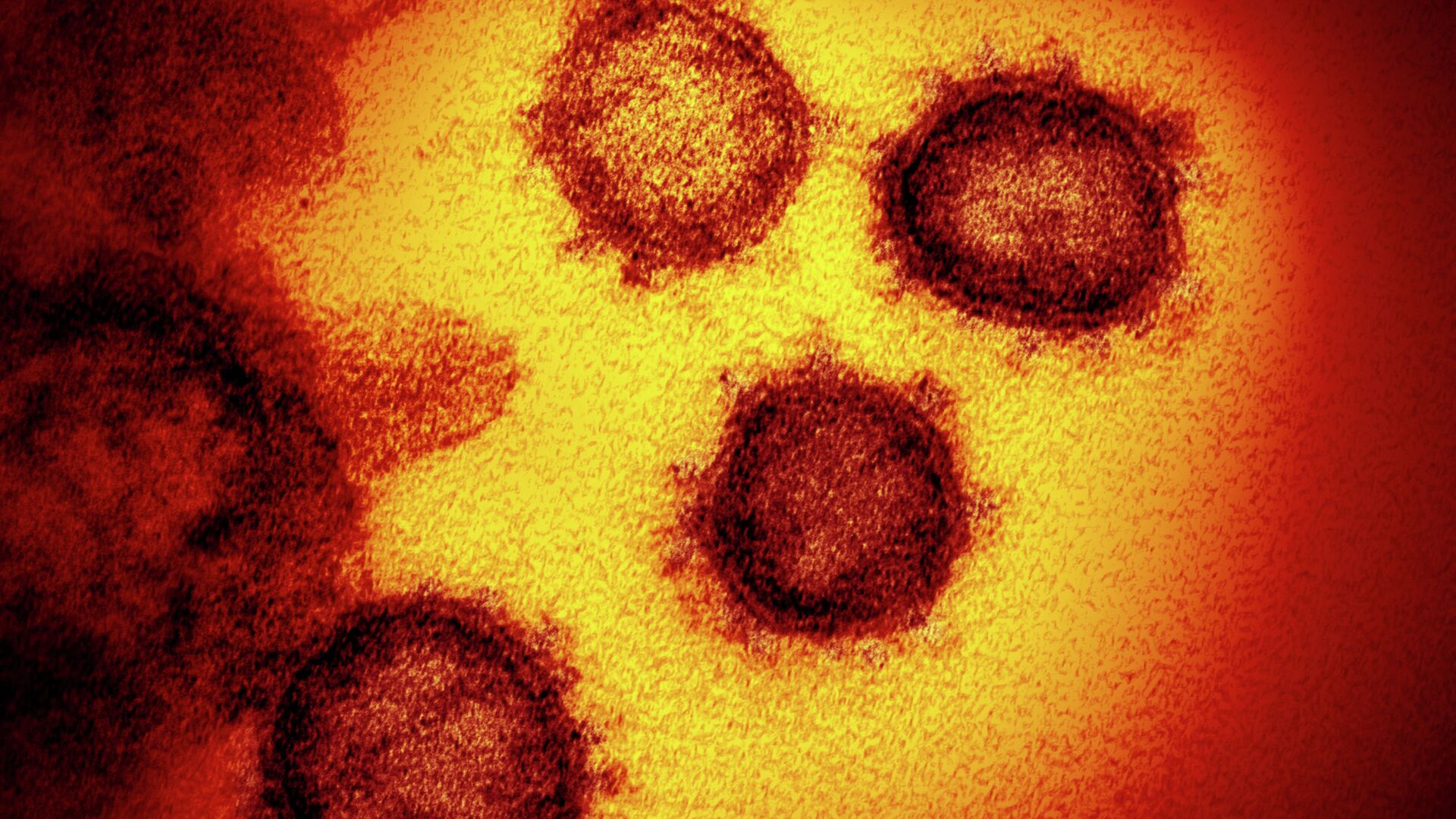 Микрофотография клеток, пораженных коронавирусом  - Sputnik Қазақстан, 1920, 04.01.2022