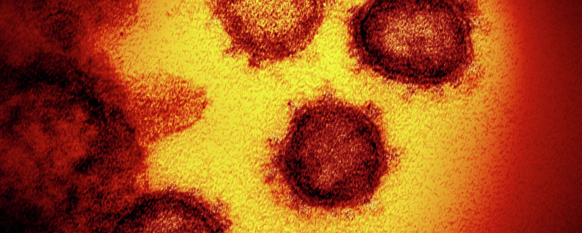 Микрофотография клеток, пораженных коронавирусом  - Sputnik Қазақстан, 1920, 04.12.2021