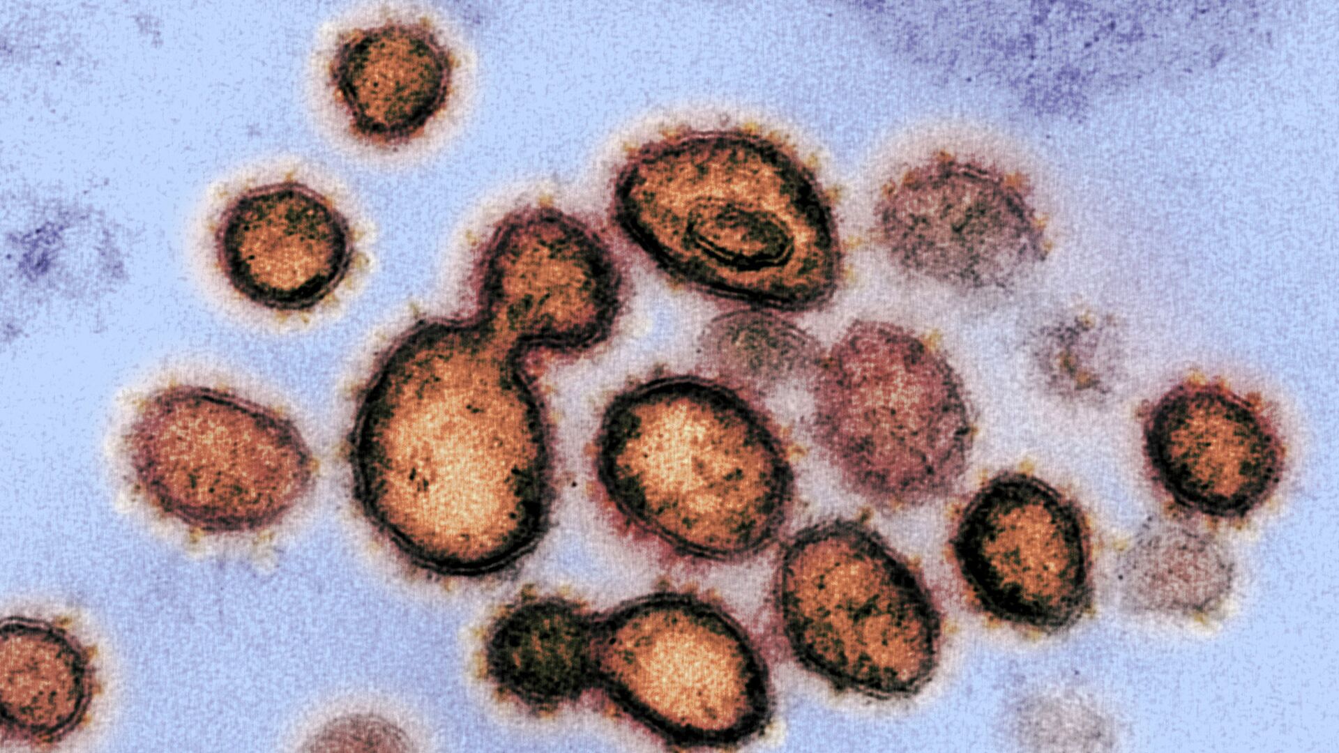 Частицы коронавируса на клетке заразившегося человека под микроскопом - Sputnik Қазақстан, 1920, 04.02.2023