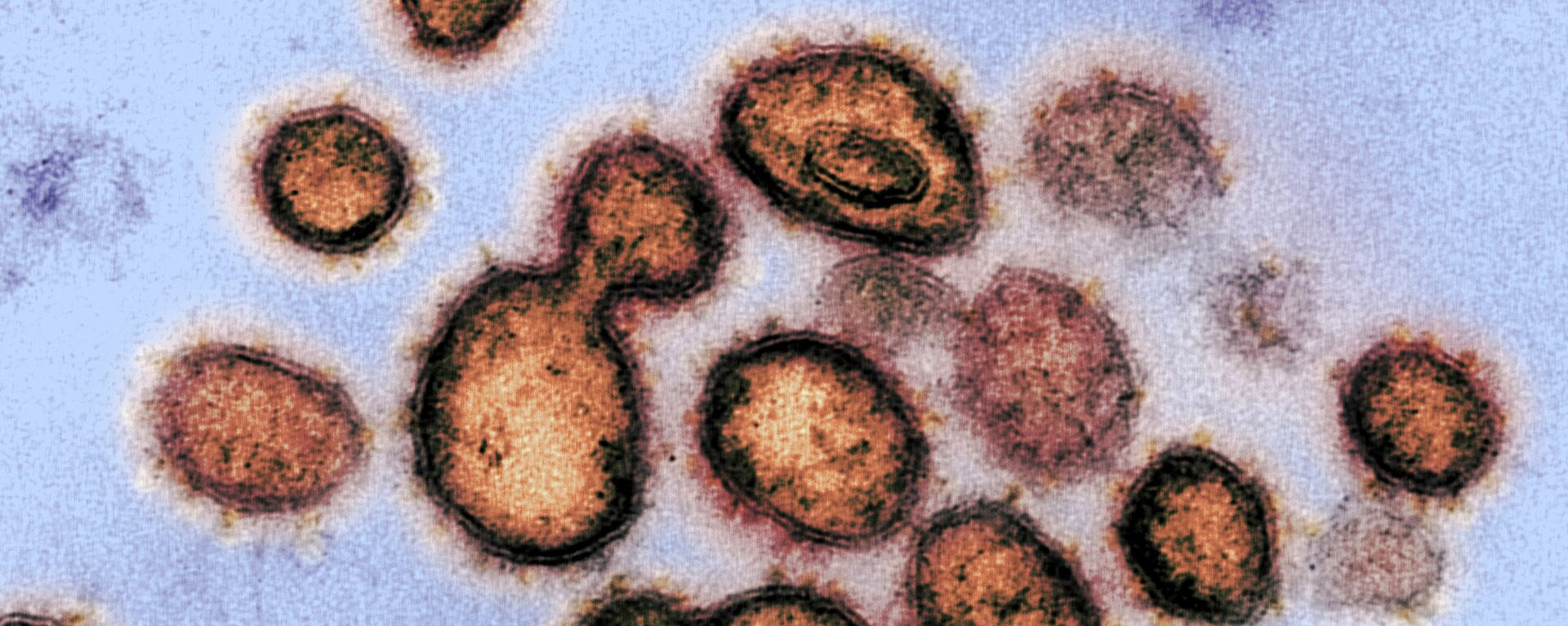 Частицы коронавируса на клетке заразившегося человека под микроскопом - Sputnik Казахстан, 1920, 16.02.2022