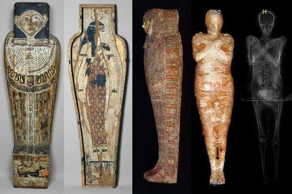 Радиологическая экспертиза древней мумии, которая была обнаружена в королевских гробницах в Верхнем Египте, доказала, что это тело беременной женщины - Sputnik Казахстан