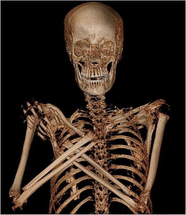 Радиологическая экспертиза древней мумии, которая была обнаружена в королевских гробницах в Верхнем Египте, доказала, что это тело беременной женщины  - Sputnik Казахстан