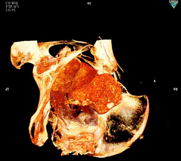 Радиологическая экспертиза древней мумии, которая была обнаружена в королевских гробницах в Верхнем Египте, доказала, что это тело беременной женщины  - Sputnik Казахстан