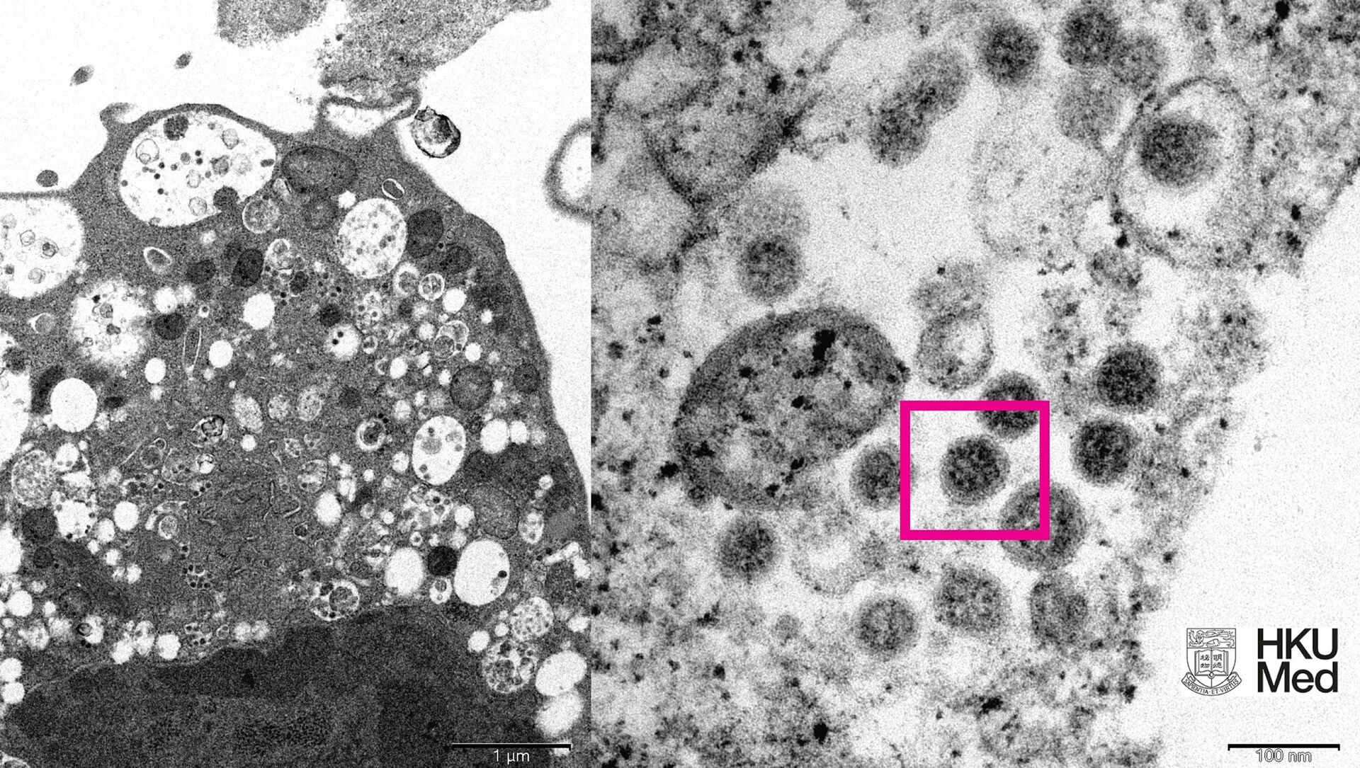 Ученые из Университета Гонконга опубликовали электронную микрофотографию омикрон-штамма - Sputnik Қазақстан, 1920, 02.01.2022