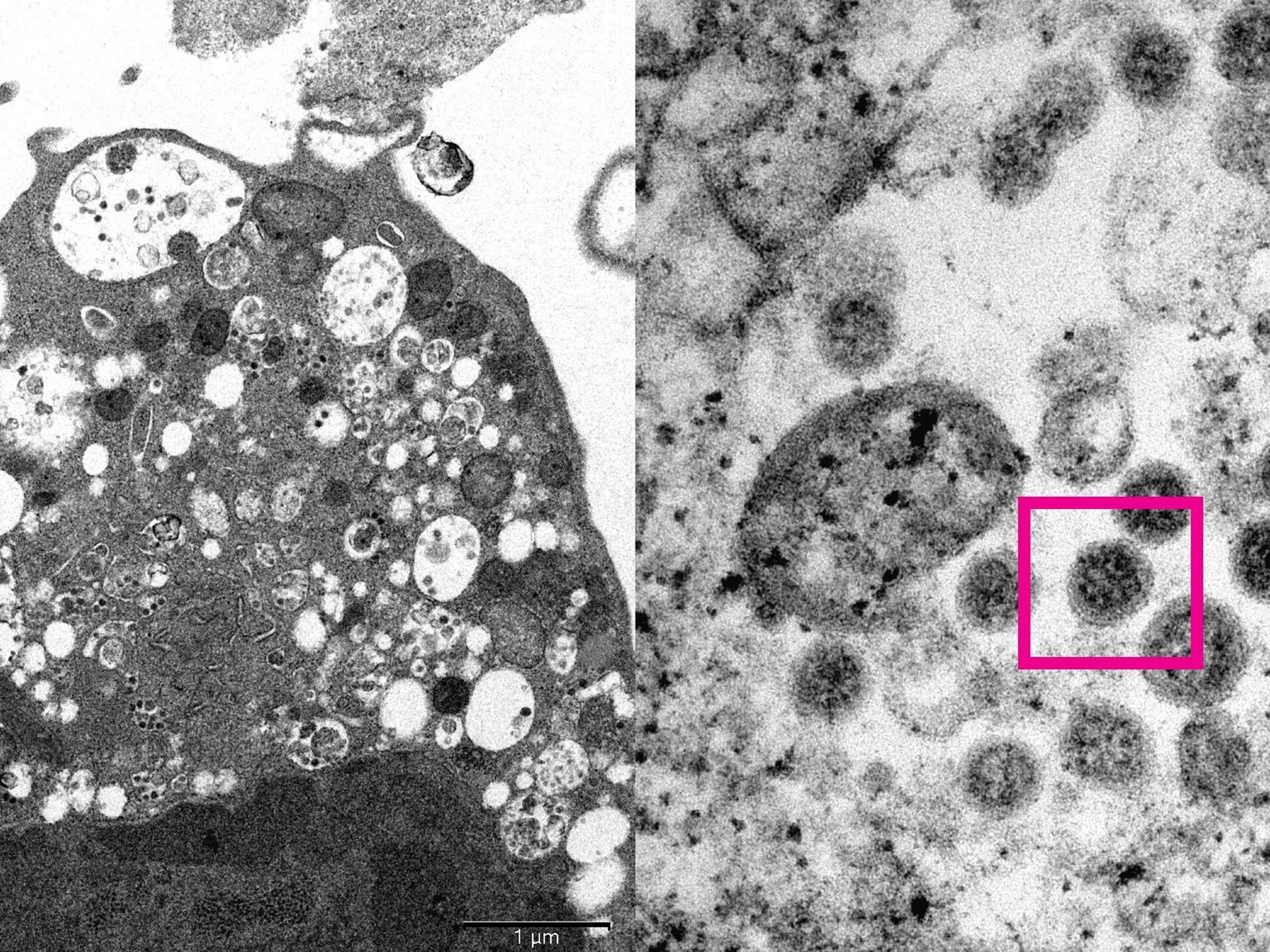 Новые штаммы коронавируса в мире. Омикрон коронавирус. Вирусы под микроскопом. Штаммы коронавируса под микроскопом.
