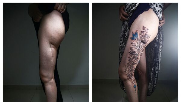 Фото до и после татуировки в рамках проекта «Мы — бриллианты» в Сан-Паулу, Бразилия - Sputnik Казахстан