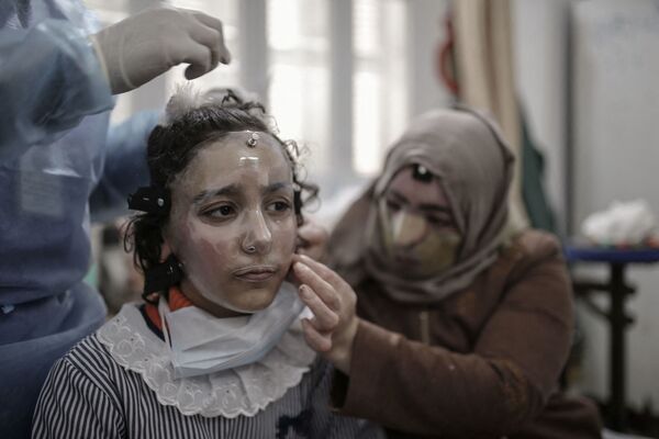Эта юная девушка из Палестины по имени  Марам и ее мать Издихар аль-Амави серьезно пострадали от ожогов. Их лица сильно обгорели в результате утечки газа в лагере палестинских беженцев. - Sputnik Казахстан