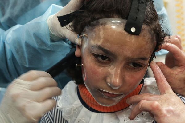 На фото: процесс надевания напечатанной на 3D-принтере прозрачной маски для лица в клинике международной благотворительной организации &quot;Врачи без границ&quot; в Газе. - Sputnik Казахстан