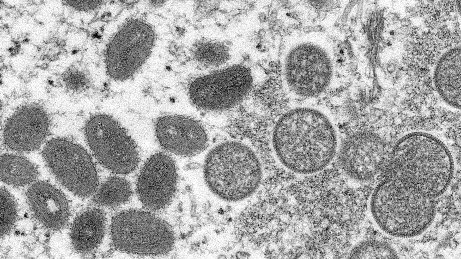 Вирус обезьяньей оспы на разных этапах инкубационного периода под микроскопом  - Sputnik Казахстан, 1920, 23.06.2022