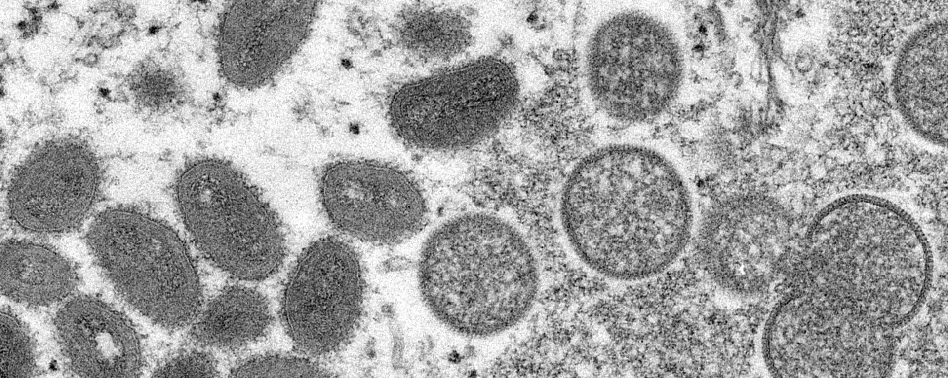 Вирус обезьяньей оспы на разных этапах инкубационного периода под микроскопом  - Sputnik Казахстан, 1920, 02.07.2022