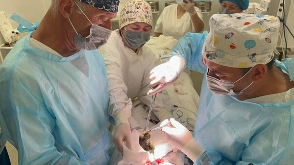 Больше килограмма волос извлекли хирурги Жамбылской области из желудка 12-летней пациентки - Sputnik Казахстан