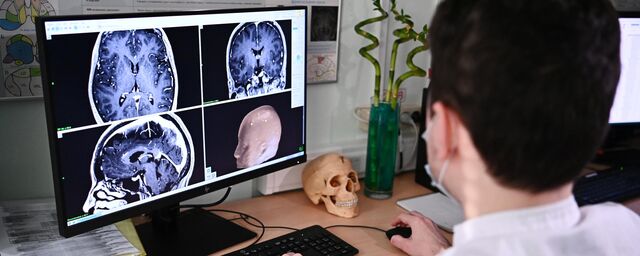 Аққұбалар аяқтың арасындағы порно