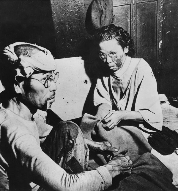 Жертвы в Хиросиме, Япония, вскоре после первого взрыва атомной бомбы. - Sputnik Казахстан