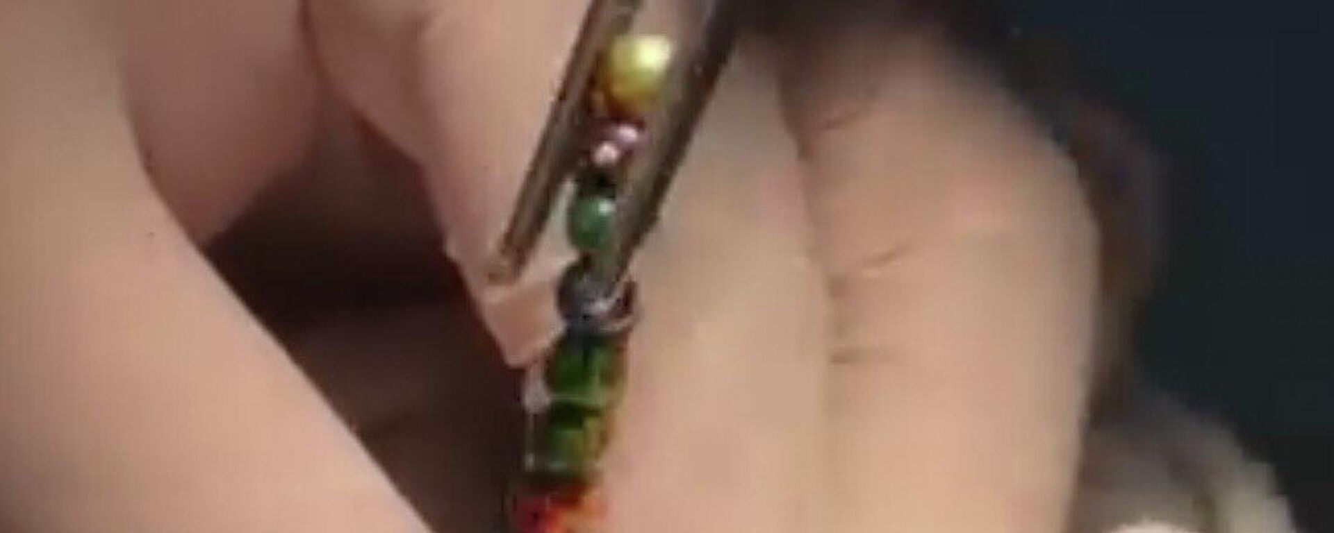 Хирурги извлекли магниты, которые проглотил ребенок в Шымкенте - Sputnik Казахстан, 1920, 18.12.2025