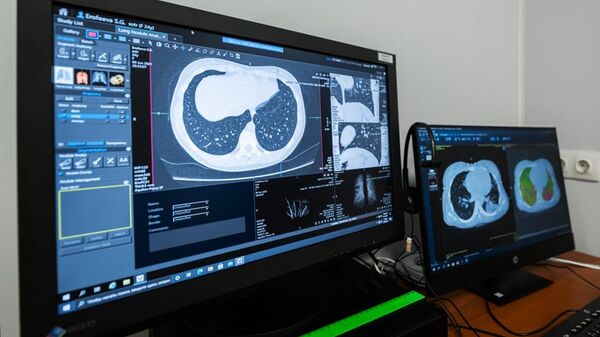 Снимок легких пациента на экране монитора в отделении диагностики в больнице, архивное фото - Sputnik Казахстан