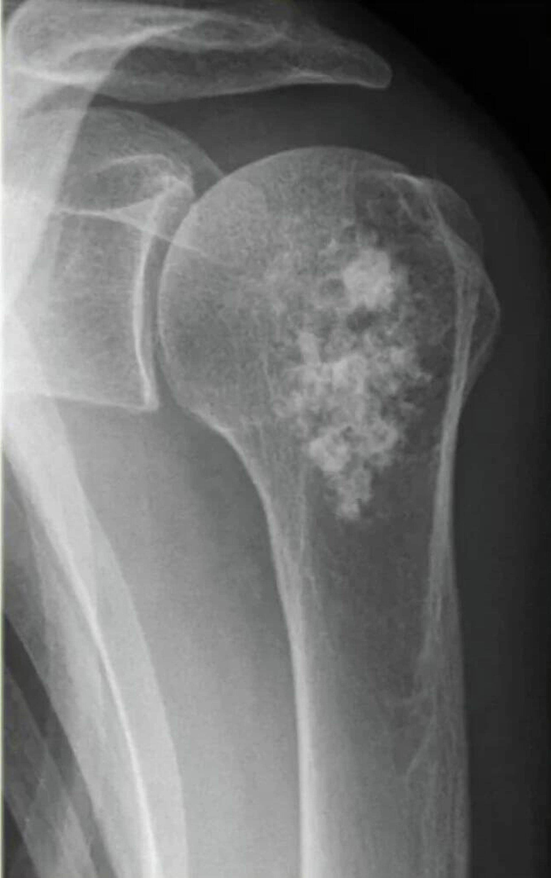 Новый препарат для лечения онкозаболеваний на основе сырья, вырабатываемого Росатомом - Sputnik Казахстан, 1920, 16.01.2026