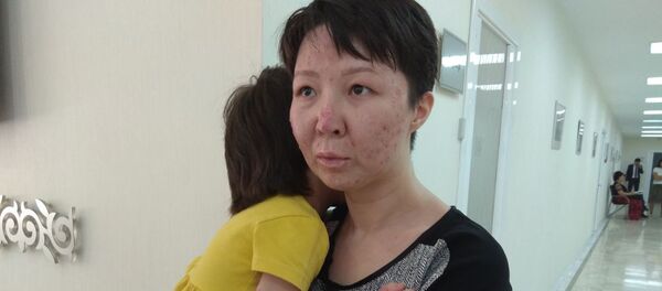 Жительница села Шидерты Павлодарской области Найляна Имашева вместе с ребенком, получившие сильные ожоги из-за взрыва газа из бытового баллона - Sputnik Казахстан