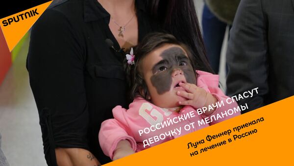 Российские врачи спасут девочку от меланомы - видео - Sputnik Қазақстан