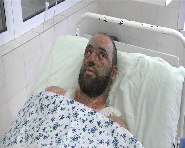 Слесарь, выживший при аварии в котельной в Рудном Слесарь, выживший при аварии в котельной в Рудном - Sputnik Казахстан