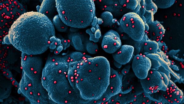 Вид на зараженную коронавирусом клетку под микроскопом - Sputnik Қазақстан