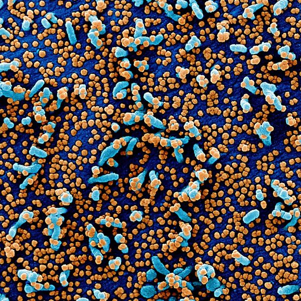 Вид на зараженную коронавирусом клетку под микроскопом - Sputnik Казахстан