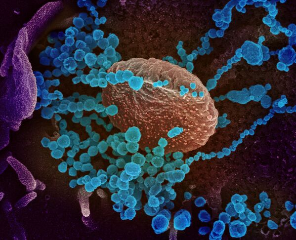 Вид на зараженную коронавирусом  клетку под микроскопом  - Sputnik Казахстан