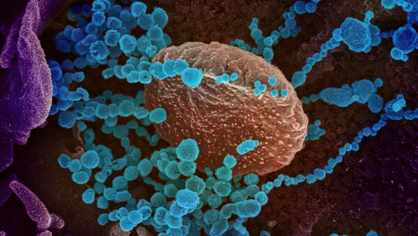 Вид на зараженную коронавирусом  клетку под микроскопом  - Sputnik Қазақстан