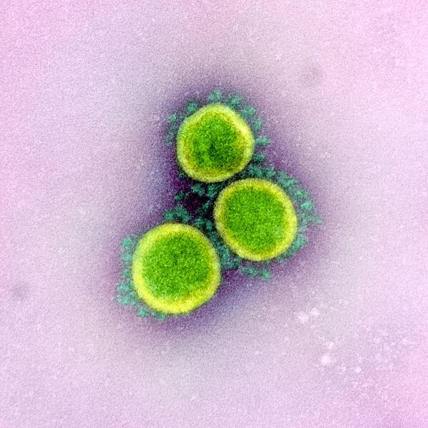 Микрофотография частиц коронавируса в клетке зараженного человека - Sputnik Казахстан