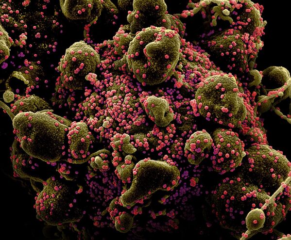 Вид на зараженную коронавирусом клетку под микроскопом - Sputnik Казахстан