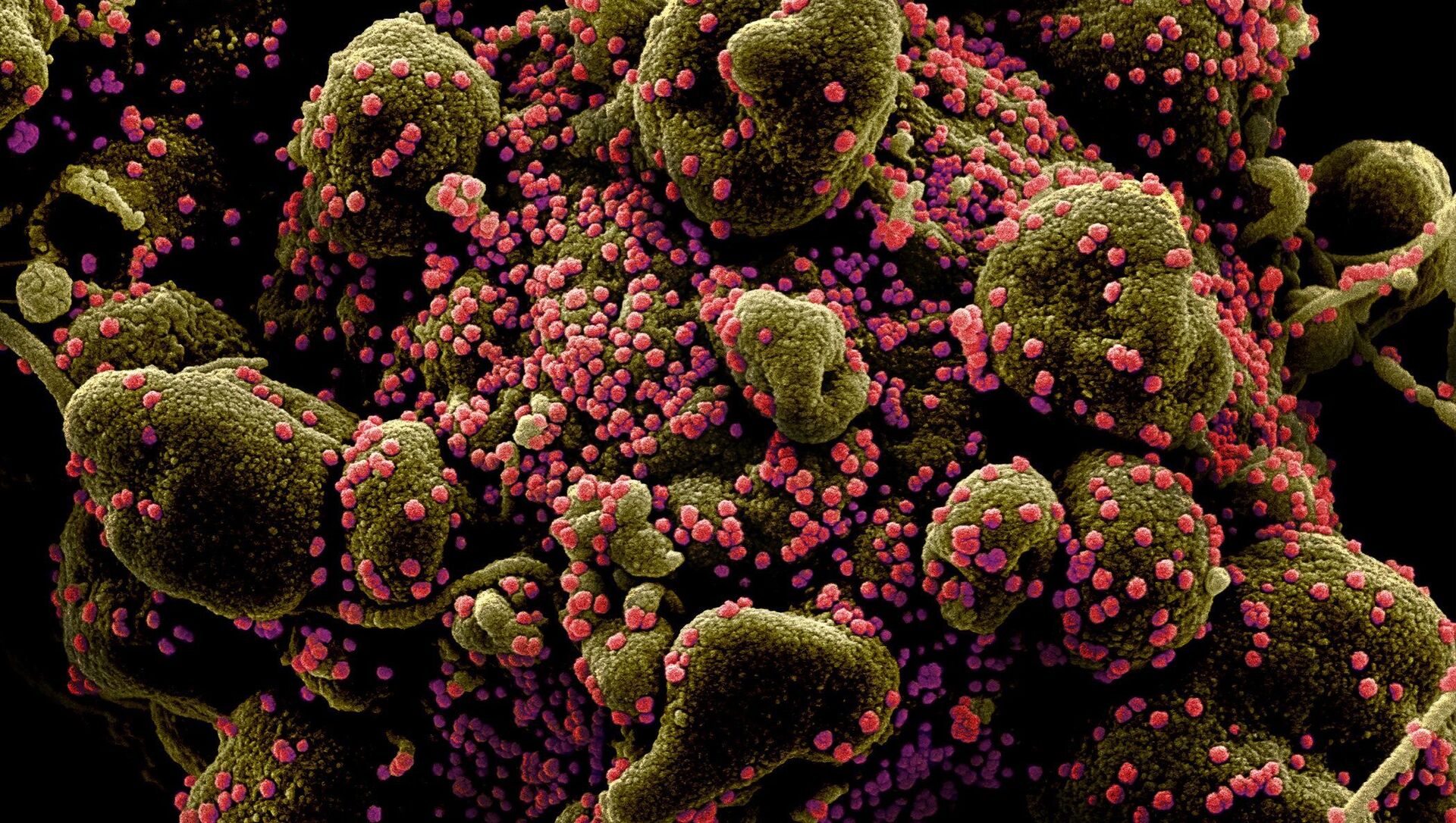 Вид на зараженную коронавирусом клетку под микроскопом - Sputnik Қазақстан, 1920, 19.01.2022