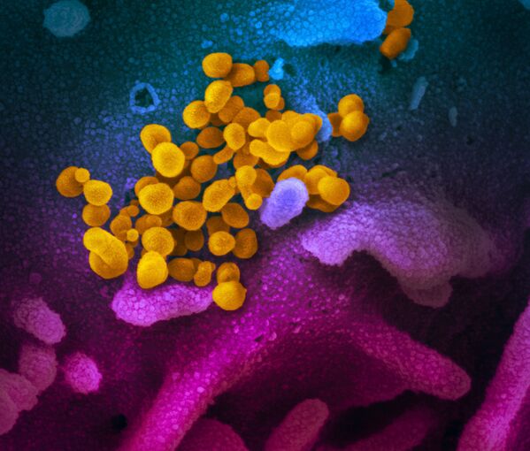 Цветное изображение нового коронавируса SARS-CoV-2  - Sputnik Казахстан