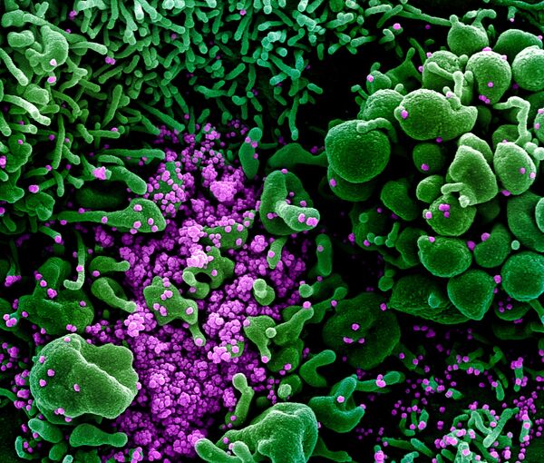 Микрофотография частиц коронавируса в клетке зараженного человека - Sputnik Казахстан