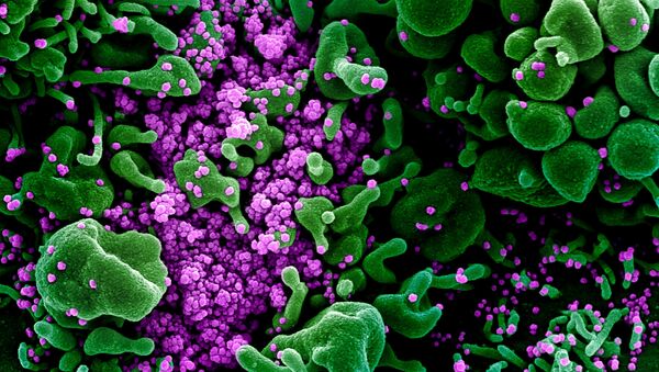 Микрофотография частиц коронавируса в клетке зараженного человека - Sputnik Қазақстан