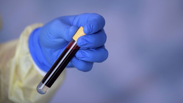 Шорттың астынан трусилар көрінеді Әйел үстемдігі алтын душ порно онлайн көру