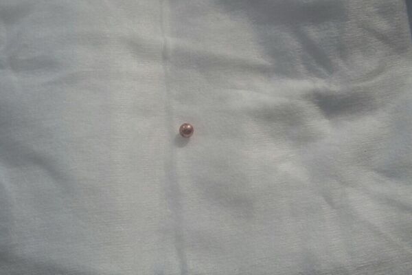 Пуля, извлеченная из головы 14-летней Валентины - Sputnik Казахстан