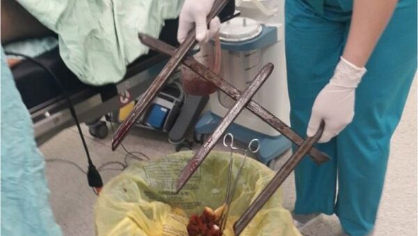Темір шарбаққа құлап кеткен ер адамға алты сағат операция жасалған - Sputnik Қазақстан
