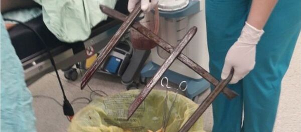 Темір шарбаққа құлап кеткен ер адамға алты сағат операция жасалған - Sputnik Қазақстан