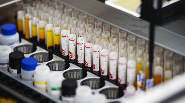 Лаборатория иммуноферментных исследований, где проходит исследование крови на инфекции, архивное фото - Sputnik Қазақстан