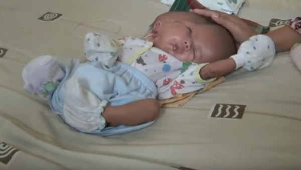 В Индонезии родился ребенок с двумя лицами - Sputnik Казахстан
